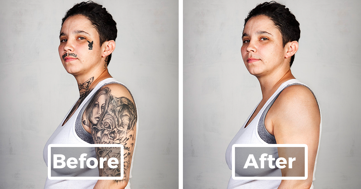 9 Ex-Gang Members With Their Tattoos Removed | Bored Panda