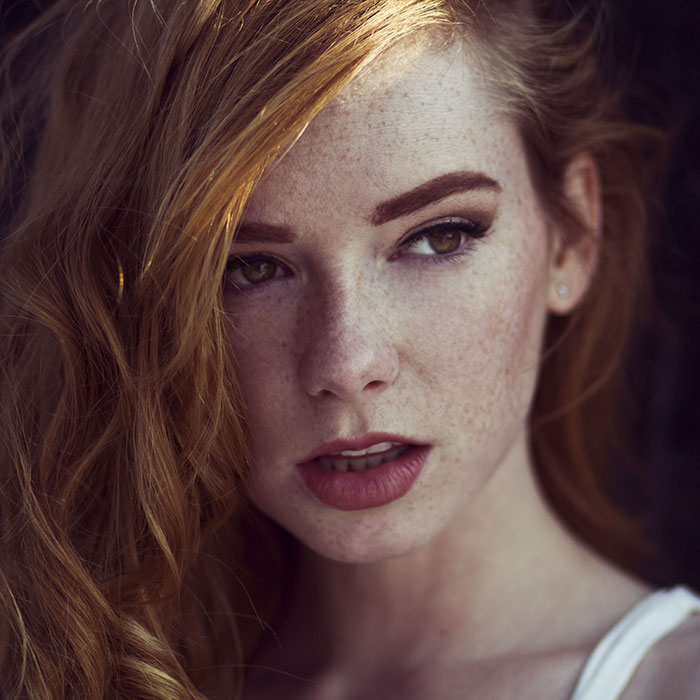 Beautiful Freckles