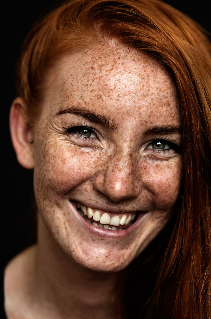 Beautiful Freckles