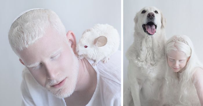 I Captured The Hypnotizing Beauty Of Albino People