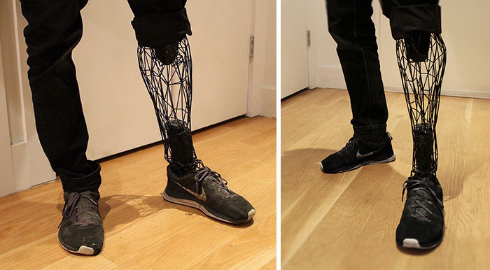 Incredible See-Through Prosthetics 3D-Printed From Titanium