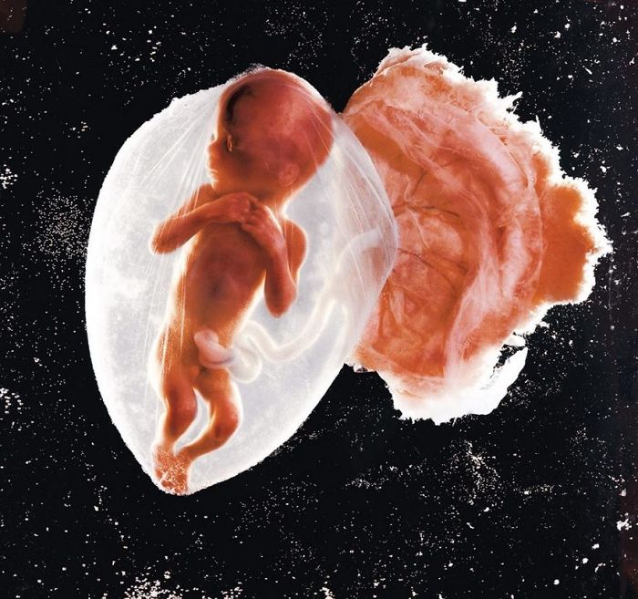 Famous photo of a fetus in utero, showcasing detailed developmental stages against a dark background.