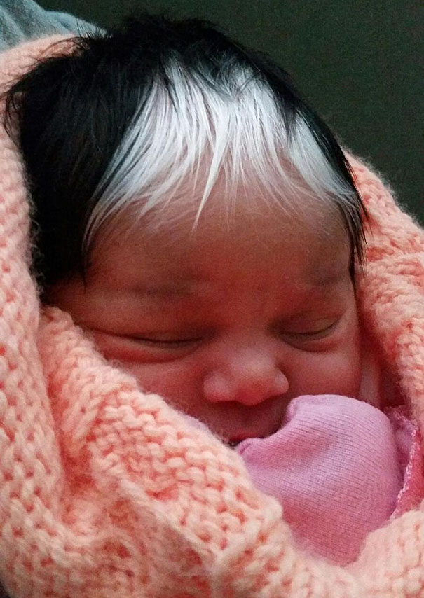 Little Girl Born With A White Patch Of Hair Which Is Exactly The Same As  Her Mum's | Bored Panda