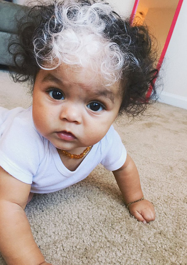 Little Girl Born With A White Patch Of Hair Which Is Exactly The Same As Her Mum's