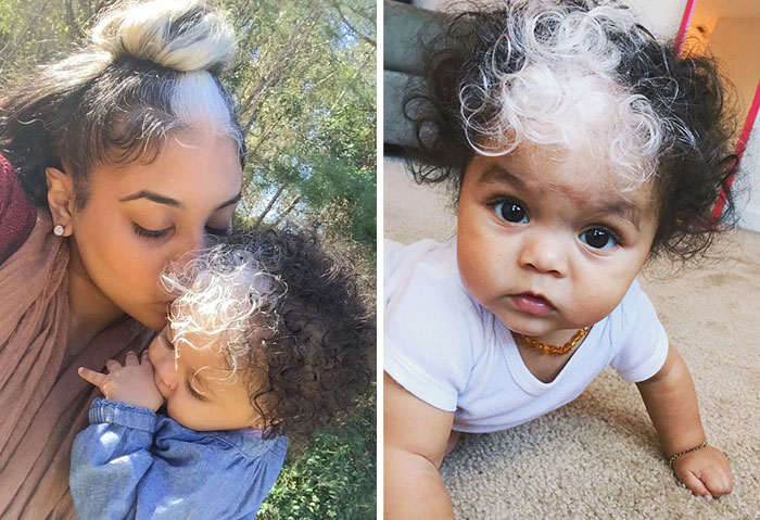 Little Girl Born With A White Patch Of Hair Which Is Exactly The Same As Her Mum’s