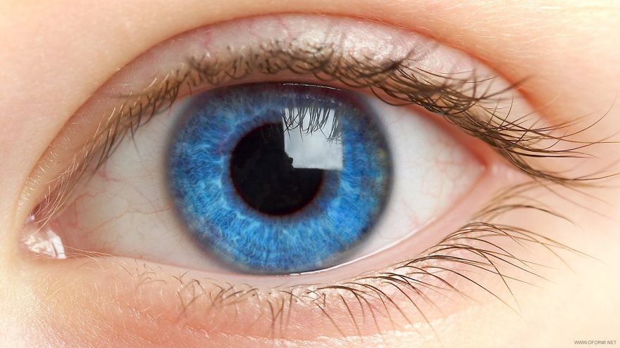 Medlikbez/eye Floaters. What Is It?