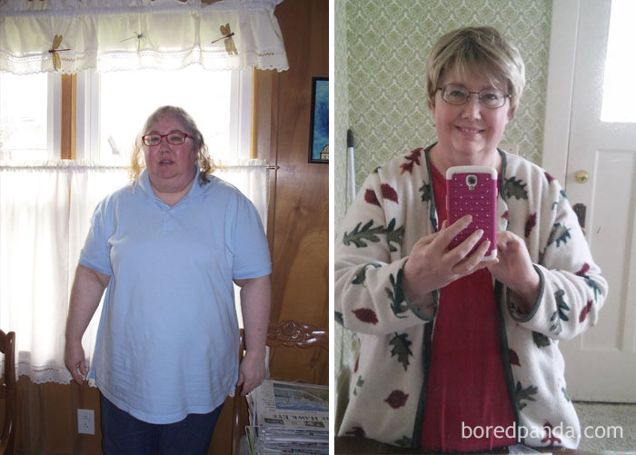 Before And After Losing 55 Pounds