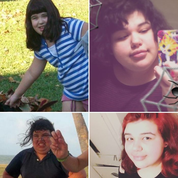 Pictures On The Right Are From My Sister Xd Luckily I Grew Up To Be Slightly Better Looking. Stil Chubby Like Before By Definatly Not As Awkward.