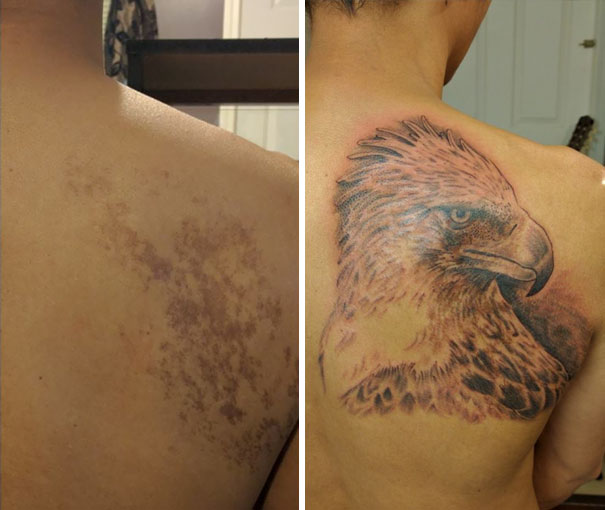 Birthmark Cover Up With A Philippine Eagle