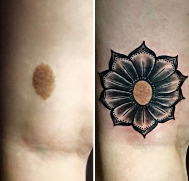 Birthmark Flower Tattoo