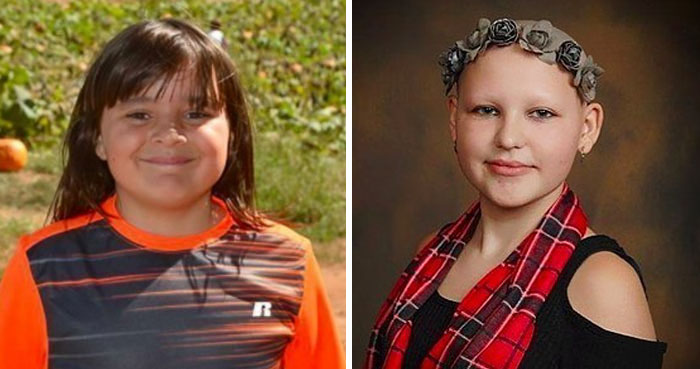 10-Year-Old Boy Grows Hair For 2 Years To Make Wig For Friend With Alopecia