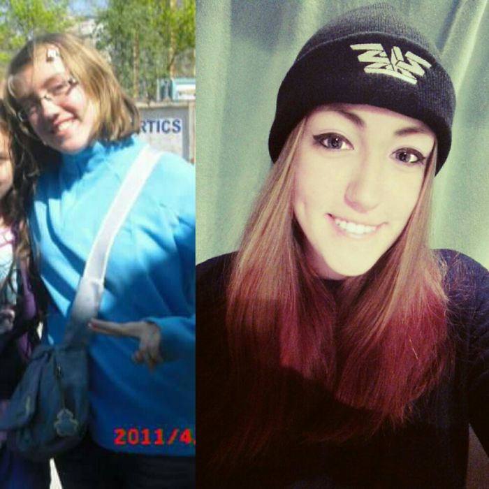 5 Years Difference(went To Gym, Got Braces, Grow My Hair, [ Btw Still Have Glasses])