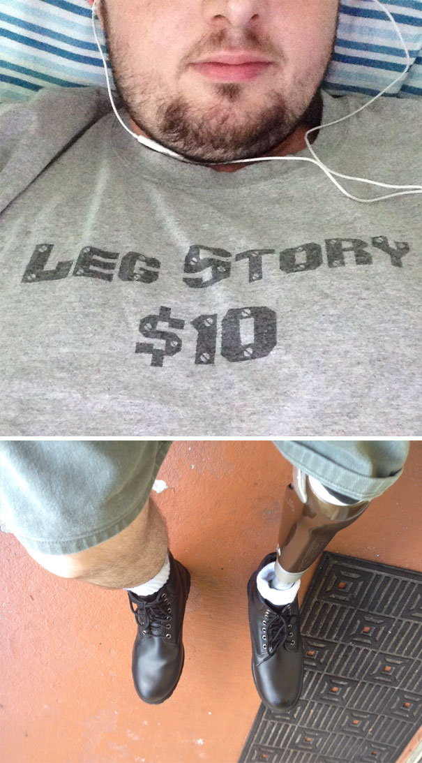 Want To Hear The Leg Story?