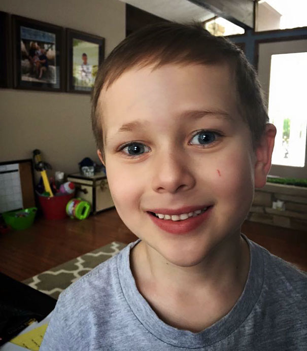 My Son Jackson (6-Years-Old) Shaved His Eyebrow Right Before Picture Day With His Dad's Nose Hair Trimmers