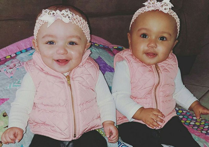 Estas raras gemelas birraciales han nacido en Illinois, y "nadie se cree que sean gemelas"