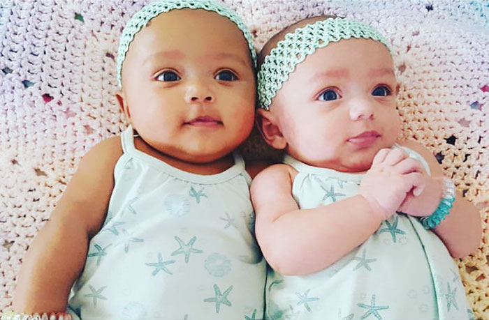 Super Rare Biracial Twins Born In Illinois, And “Nobody Believes They’re Twins”