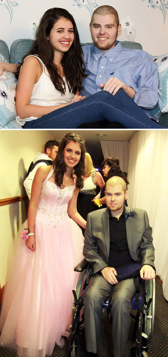 A Scottish Teen Fulfilled His Dying Wish Of Taking His Girlfriend To The Prom