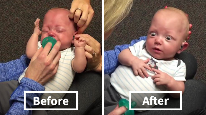 Baby Hears Mom For The First Time After Receiving Hearing Aids, And His Reaction Will Melt Your Heart