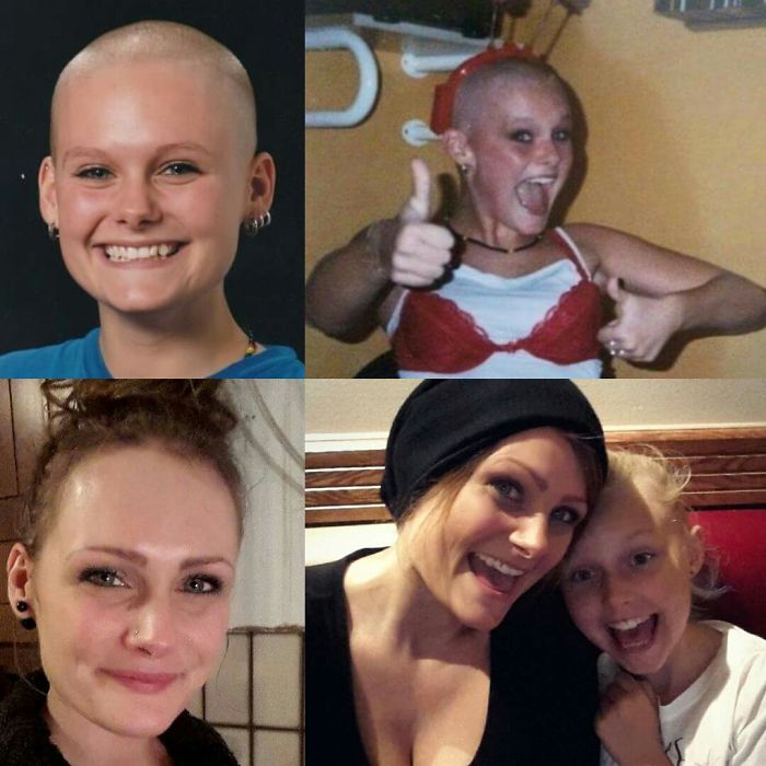 Top Pics: 1998, 16 Years Old And Going Through An "i Don't Need Hair" Fase. Bottom Pics: 2016, 34 Years Old And Mom To A 10 Year Old Daughter. Still A Bit Edgy...wouldn't Want It Any Other Way.