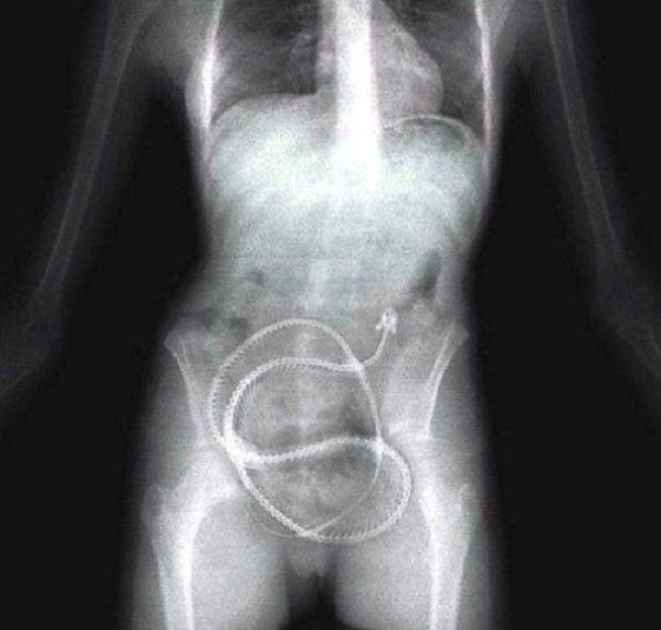 Teod | 13 Viral Photos - Fact Or Fiction