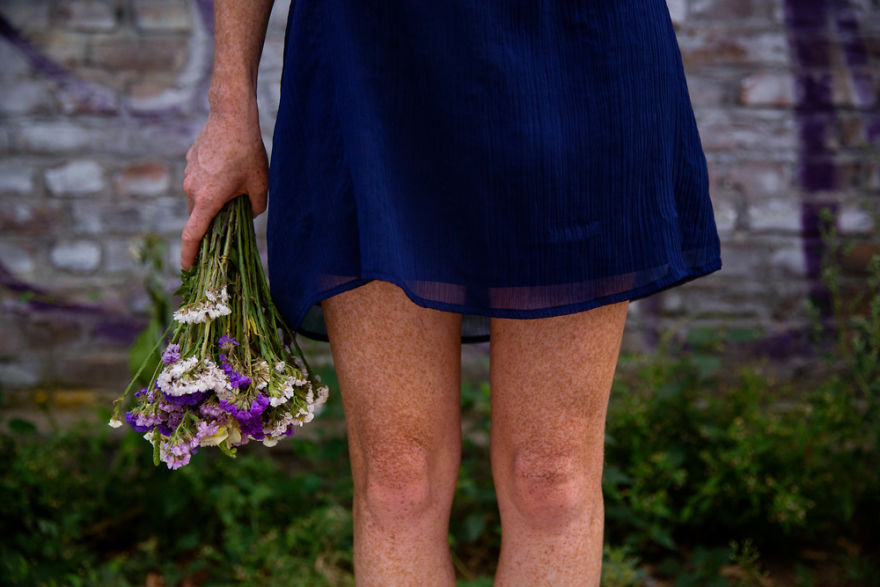 The Freckled Legs Of A Girl From Budapest