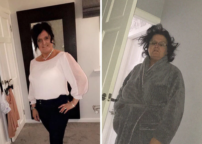 Post A Picture Of You Before And After A Night Out