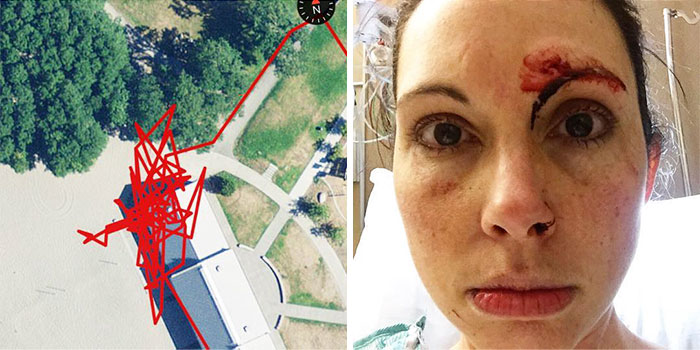 Jogger's Fight With Sex Attacker Gets Recorded On Fitness Tracker; Attacker's Face Looks Worse Than Victim's