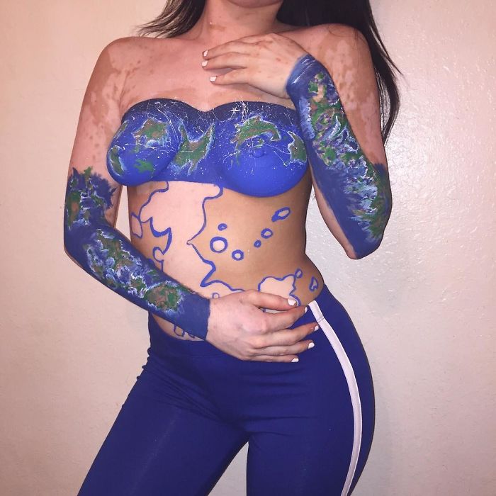 After Being Bullied For Vitiligo All Her Life, This Girl Now Turns Her Body Into Amazing Art