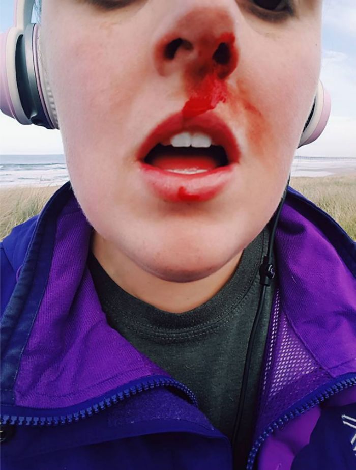 Woman Confronts Teenagers Torturing A Baby Seal, Gets Punched In The Face