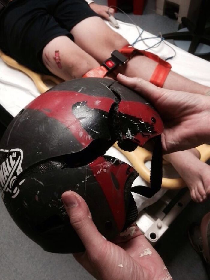 And This, Kids, Is Why We Wear Helmets When We Skateboard