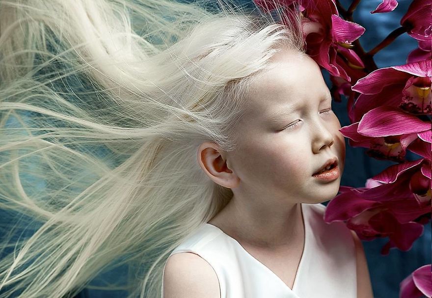 This Adorable Siberian Albino Girl Is Being Nicknamed &lsquo;Snow White&rsquo;
