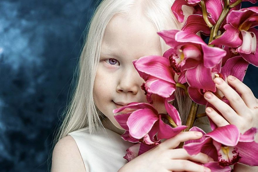 This Adorable Siberian Albino Girl Is Being Nicknamed &lsquo;Snow White&rsquo;