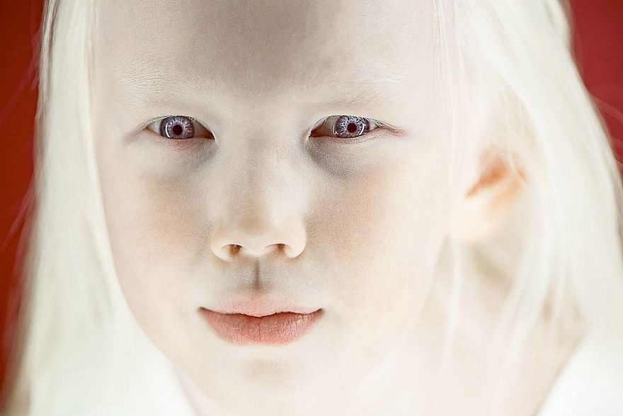 This Adorable Siberian Albino Girl Is Being Nicknamed &lsquo;Snow White&rsquo;