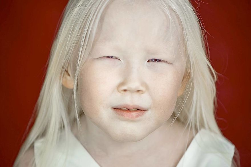 This Adorable Siberian Albino Girl Is Being Nicknamed &lsquo;Snow White&rsquo;