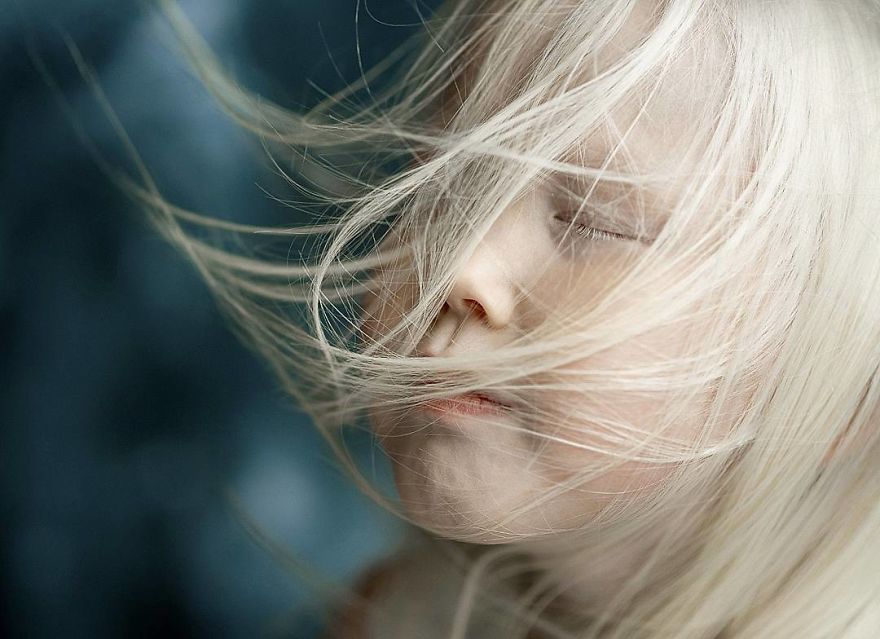 This Adorable Siberian Albino Girl Is Being Nicknamed &lsquo;Snow White&rsquo;