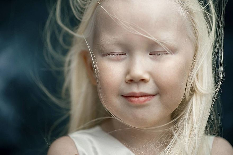 This Adorable Siberian Albino Girl Is Being Nicknamed &lsquo;Snow White&rsquo;