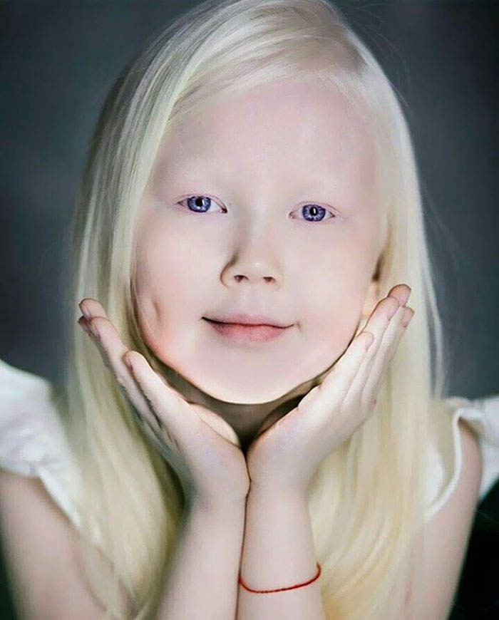 8-Year-Old "Siberian Snow White" Surprises Modeling Agencies With Unique Beauty, Gets Flooded With Offers
