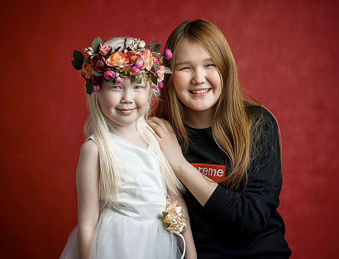 8-Year-Old "Siberian Snow White" Surprises Modeling Agencies With Unique Beauty, Gets Flooded With Offers