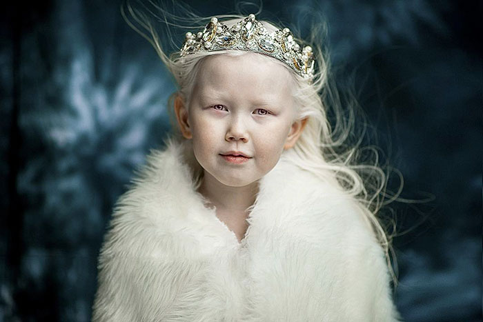 8-Year-Old “Siberian Snow White” Surprises Modeling Agencies With Unique Beauty, Gets Flooded With Offers