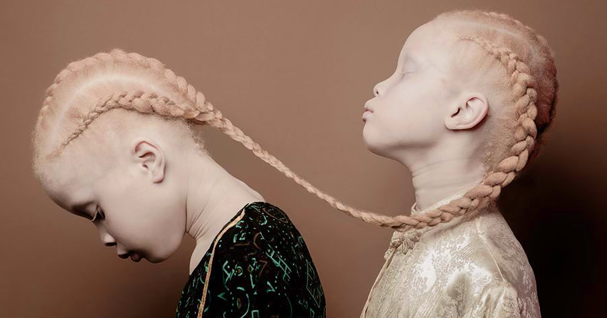 https://static.boredpanda.com/blog/wp-content/uploads/2017/04/albino-twins-models-fb.png