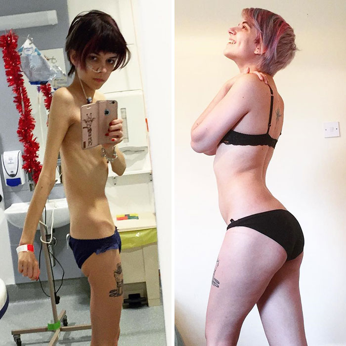 1 Year Difference - This Is To Hopefully Show You That No Matter How Lost You Are In Your Own Head, It Is Possible To Escape! It Is Possible To Find Happiness Again