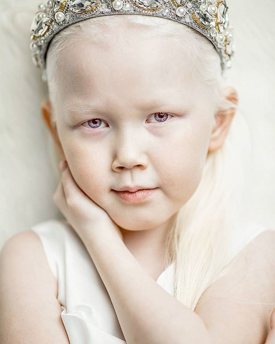 This Adorable Siberian Albino Girl Is Being Nicknamed &lsquo;Snow White&rsquo;