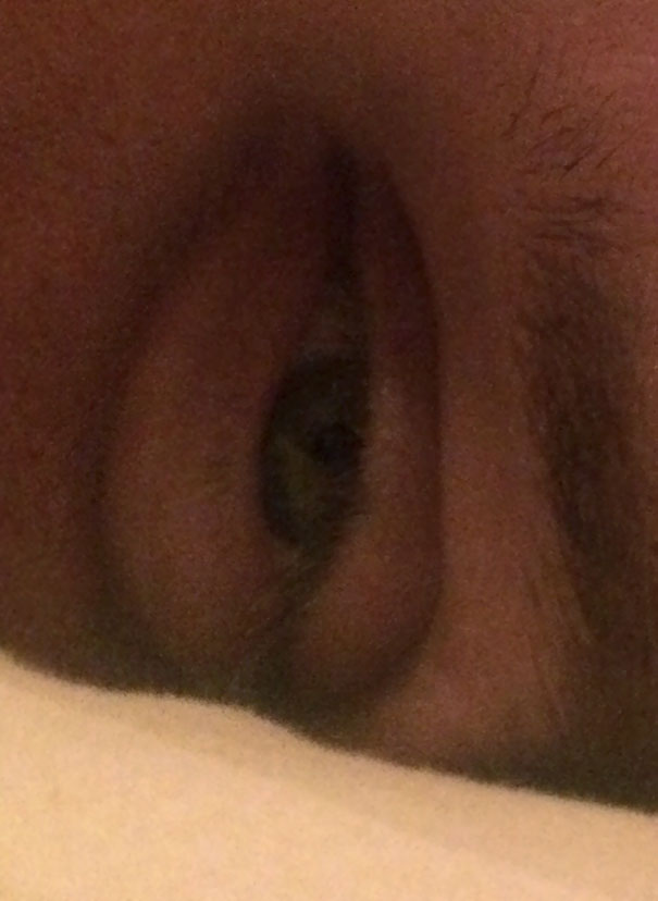 I Told My Husband That When He Gets Tired His Eyes Turn Into Eye Vaginas, He Didn't Believe Me So I Took A Pic And Rotated It