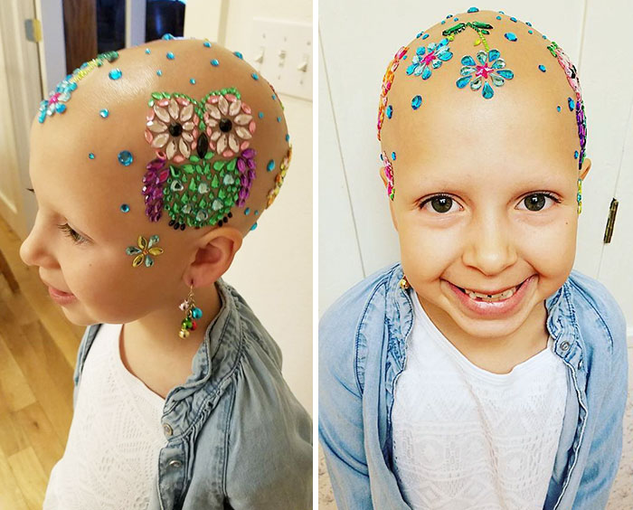 This 7-Year-Old Girl Didn't Let Alopecia Stop Her From Dazzling Everyone At School On Crazy Hair Day