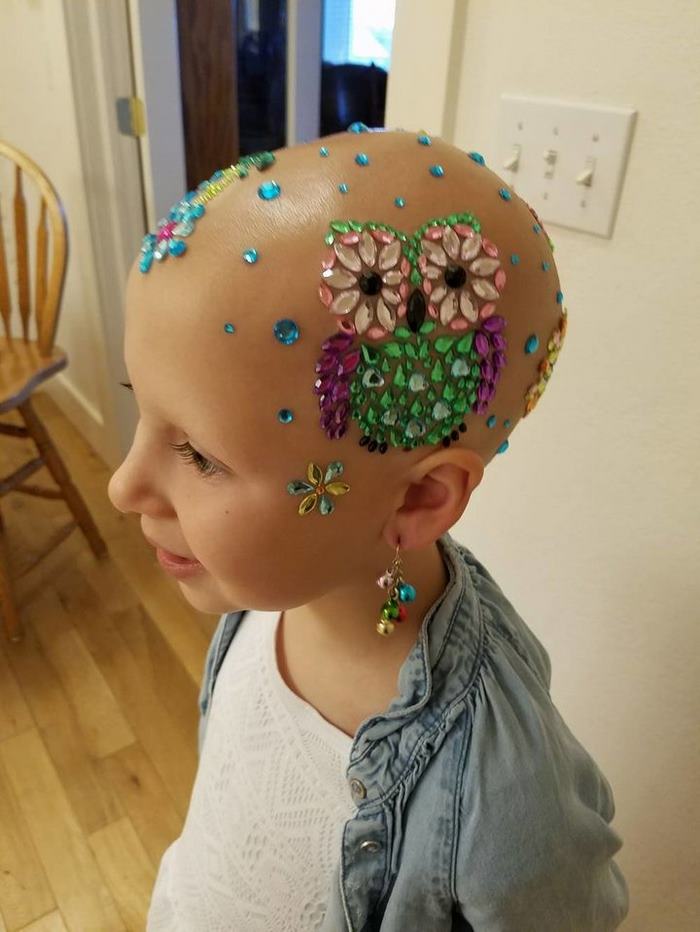 This 7-Year-Old Girl Didn't Let Alopecia Stop Her From Dazzling Everyone At School On Crazy Hair Day