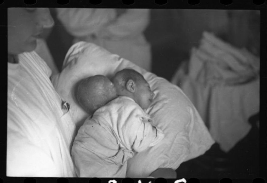 1940-1944: Nurse Holding Baby Before Surgery