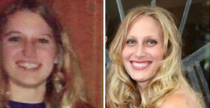 My Mom On The Left And Me On The Right. Both At The Age 34