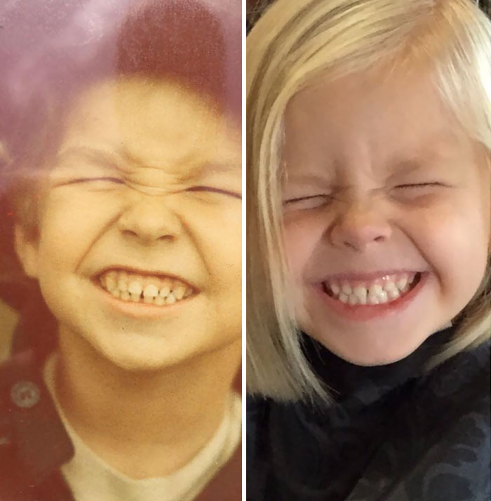 I Found This Old Photo Of Myself (Left), And I Always Knew My Daughter Molly (Right) Had A Beautiful Smile. Now I Know Why!