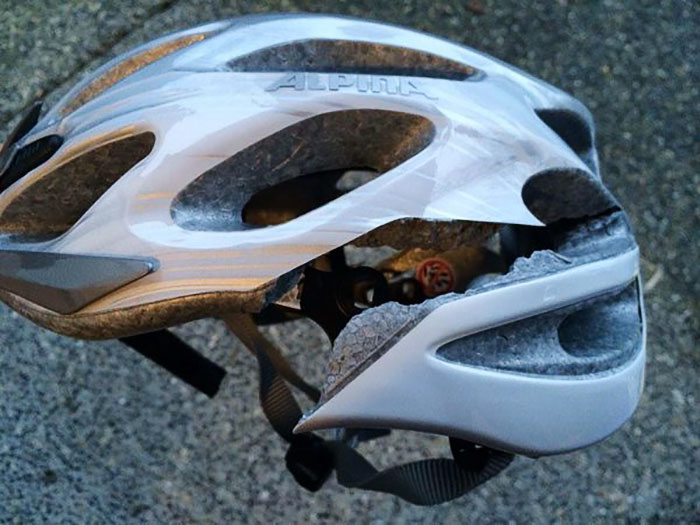 My Friend Has A Concussion After A Bike Accident. His Helmet Saved His Life. Wear Your Helmet!