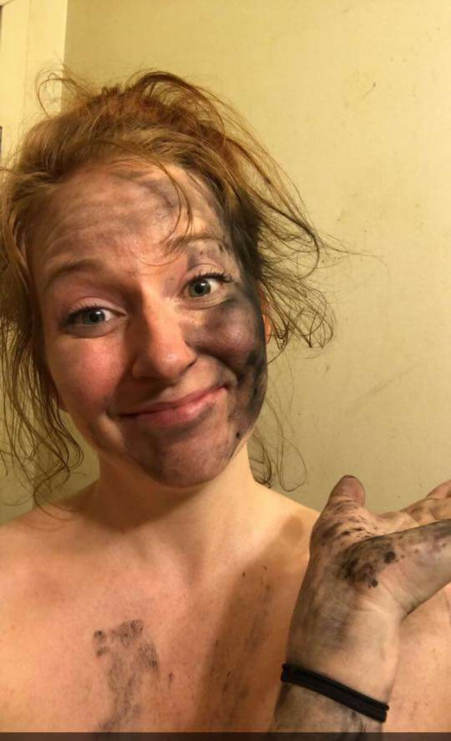 Daughter's Diy Teeth Whitening Experience! Daughter's Diy Teeth Whitening Experience!